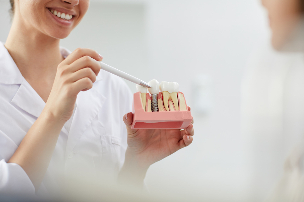 dentalImplants